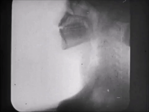 thorax